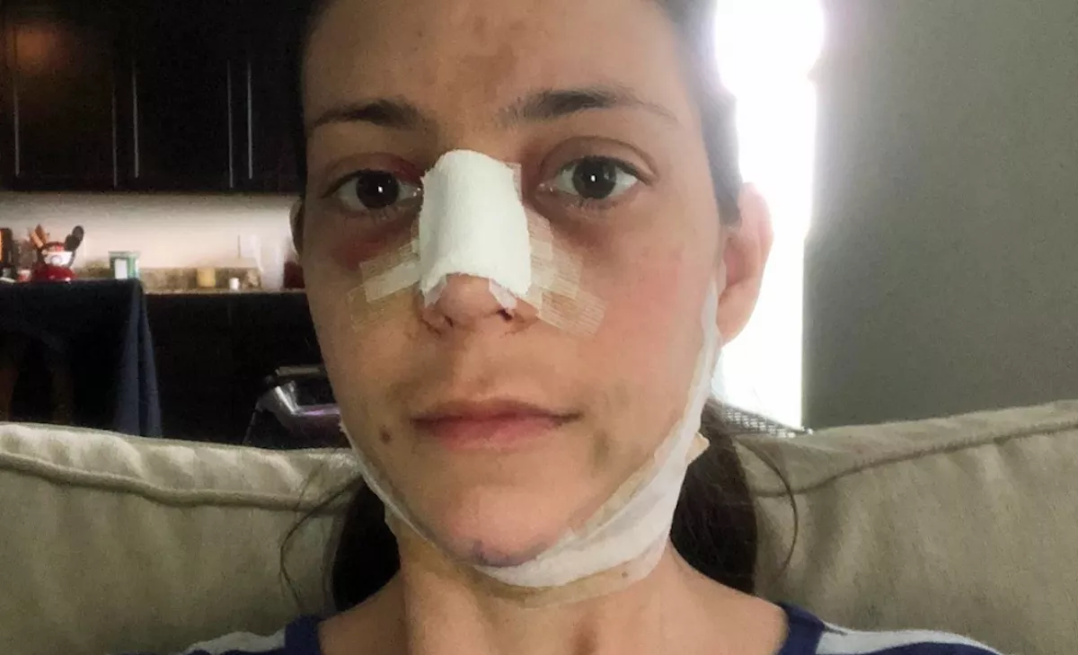 FOTÓK: 7 milliót fizetett ez a 3 gyerekes anyuka, hogy Meghan Markle-é operálják - így néz ki!