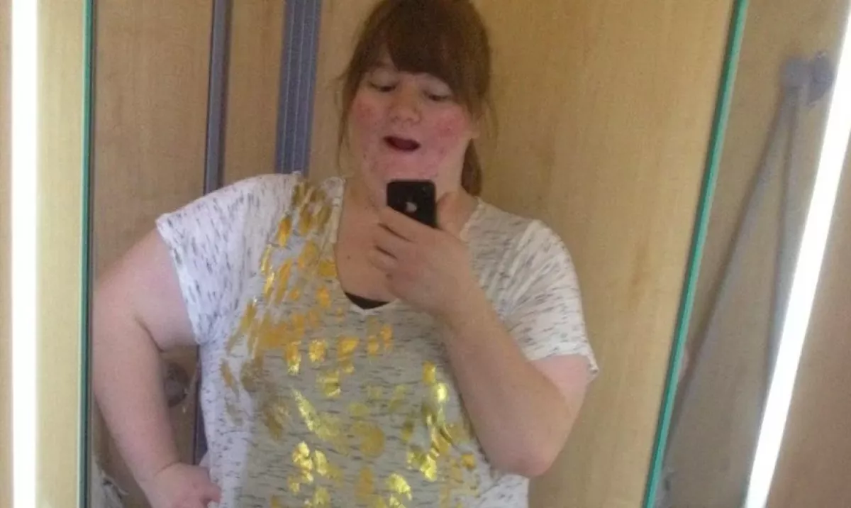 NAPI 5 LITER SZÓDÁT IVOTT: 130 kilót dobott le Erika - Fotók