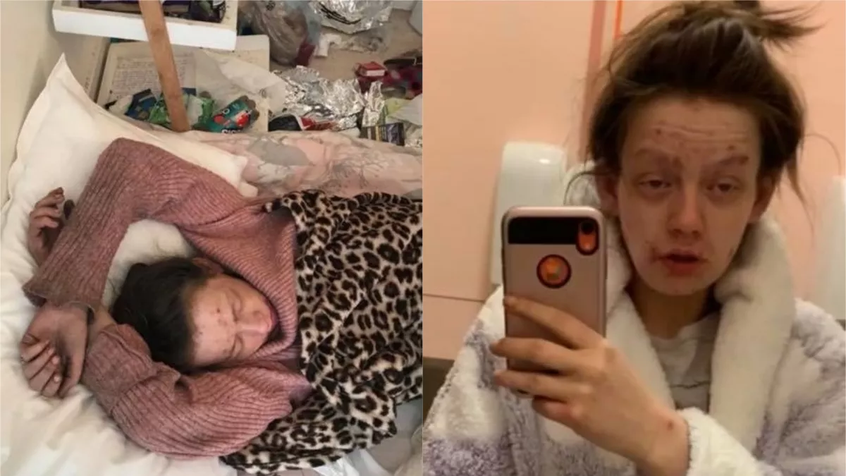 Két éven át drogozott ez a lány, friss képein rá se ismernél! - FOTÓK