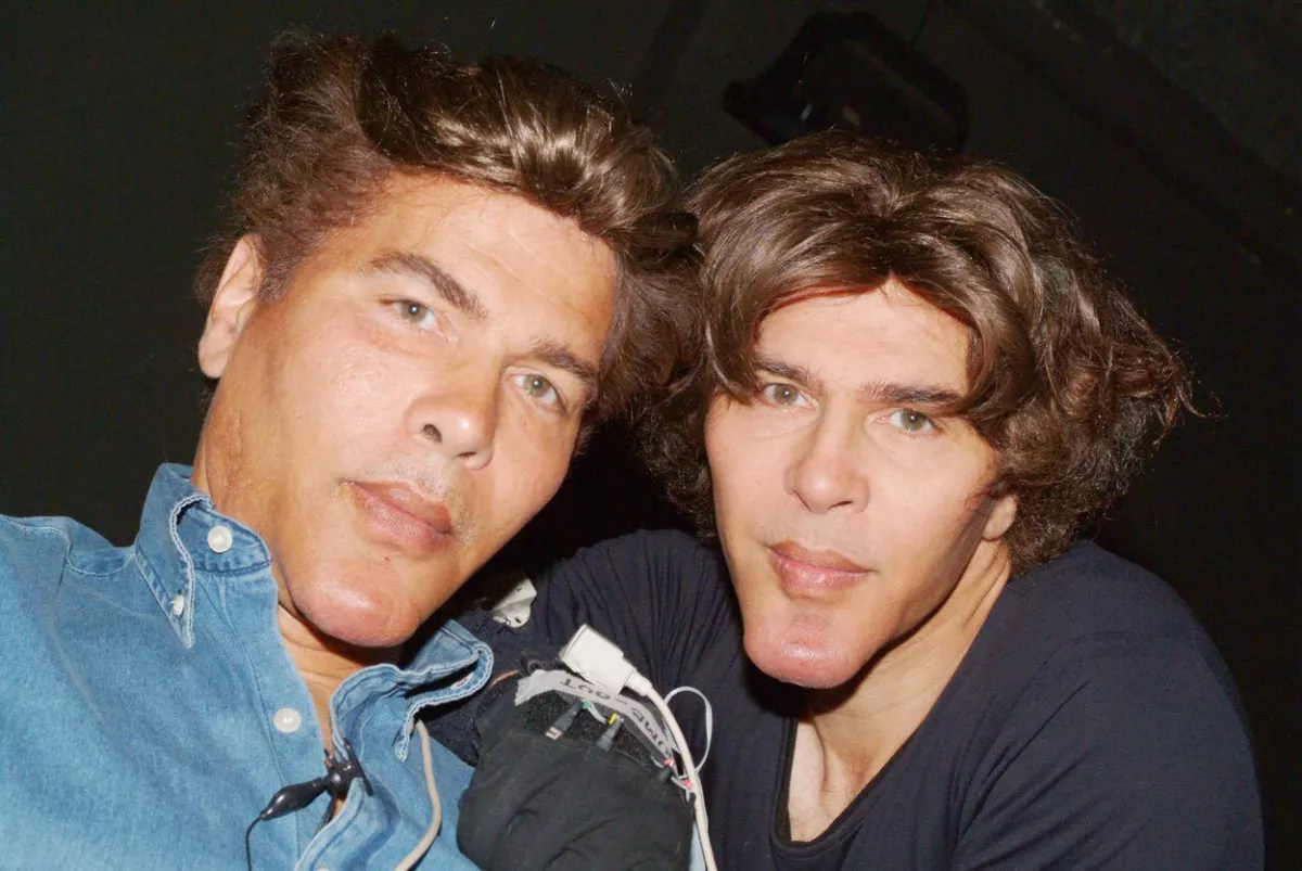 Koronavírus: a Botox-ikrek egyike meghalt, a másik intenzíven!