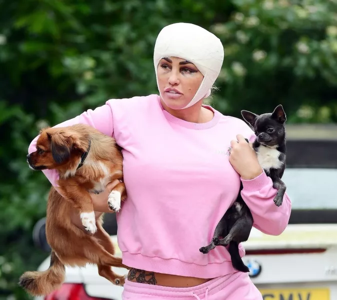 Katie Price plasztika