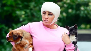 LEVETTÉK A KÖTÉST: maszkot operáltak Katie Price arcára? Új ember lett! - FOTÓK