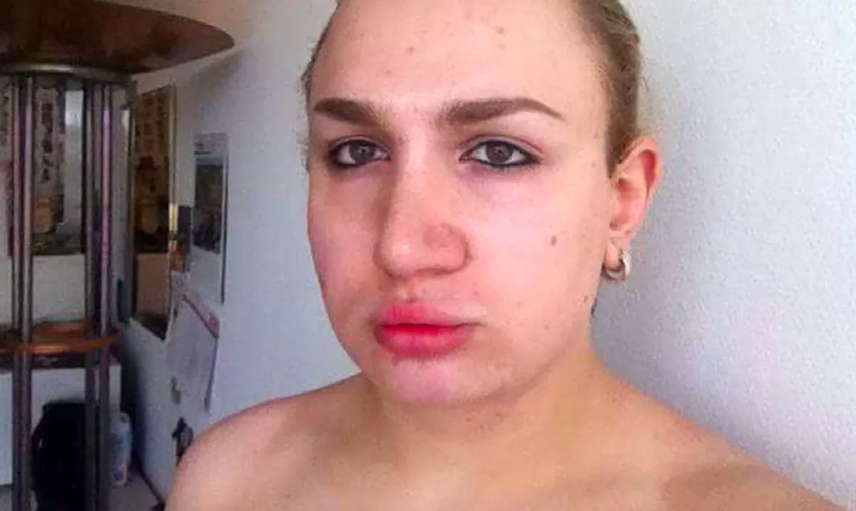 50 milliót költött ez a srác, hogy élő szexbaba legyen belőle - Ilyen lett! - Fotók