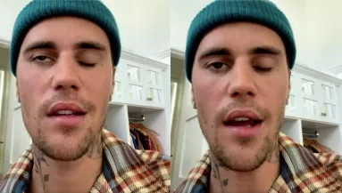Sokkoló videó: lebénult Justin Bieber fél arca - koncerteket mond le