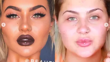 Retus nélkül leplezi le a sztárok, influenszerek valós énjét ez az Insta-oldal - Fotók