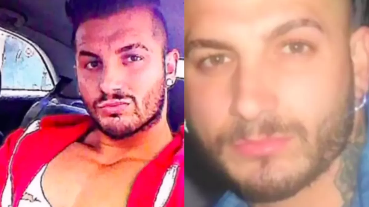 Le akarja vágatni az egyik lábát a srác, aki Alienné operáltatta magát - Fotók