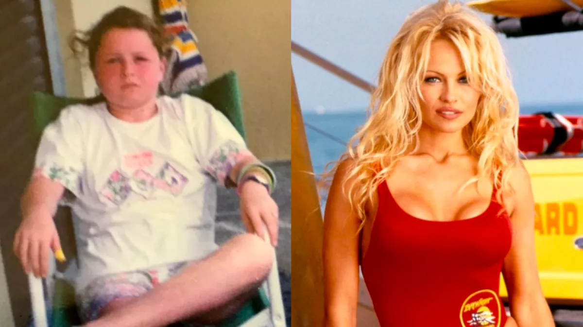Fotók: 20 milliót költött ez a nő, hogy Pamela Anderson-ná operálják - Elvileg kész