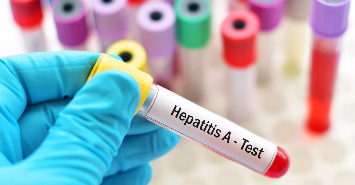 Ne edd meg! Hepatitis vírus miatt hívtak vissza egy népszerű terméket