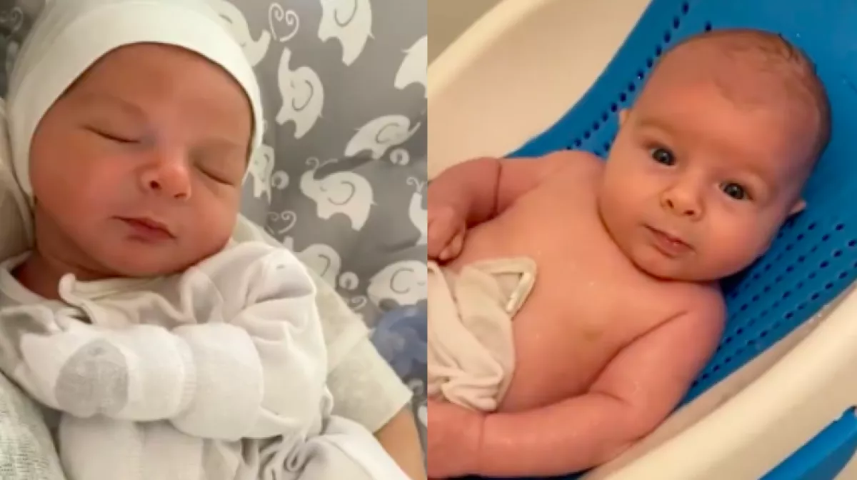 Kihullott a baba haja a születése után, ami ezután a fejére nőtt, nem csak a szüleit lepi meg - Fotók