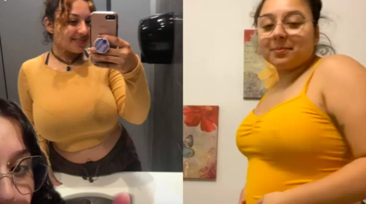 Mellkisebbítő műtétre ment ez a lány, ami ezután történt, az kétségbe ejti - Videó