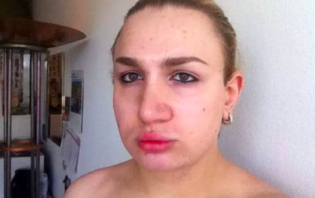 Élő cicababává műttette magát ez a srác, bár smink nélkül sokan megijednek tőle - Fotók