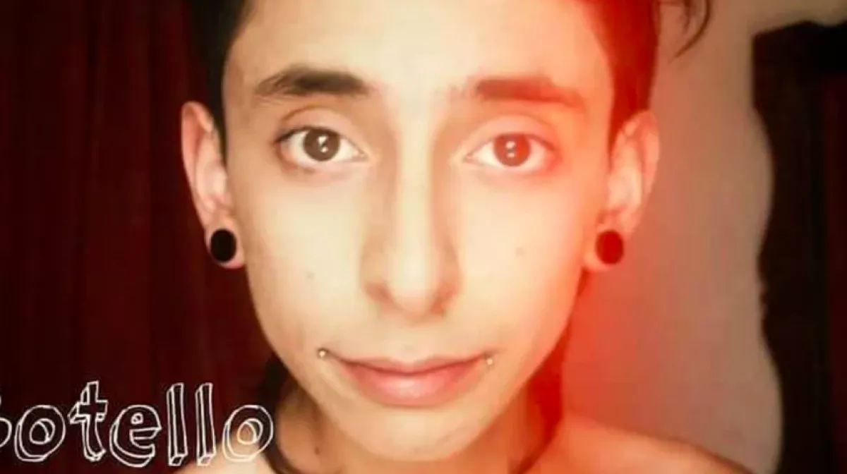 Gyíkorr, szarv, manófül - Démonná plasztikáztatta magát ez a 25 éves apa - Fotók