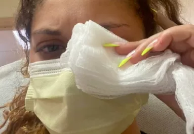 Horror: szemcsepp helyett pillanatragasztót nyomott a szemébe, így van most - Videó