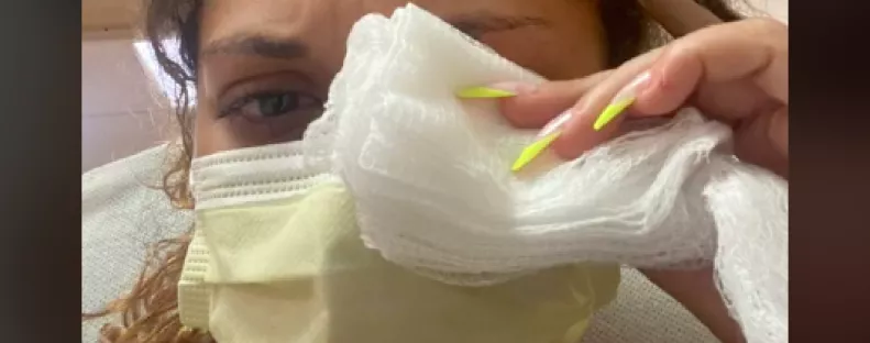 Horror: szemcsepp helyett pillanatragasztót nyomott a szemébe, így van most - Videó