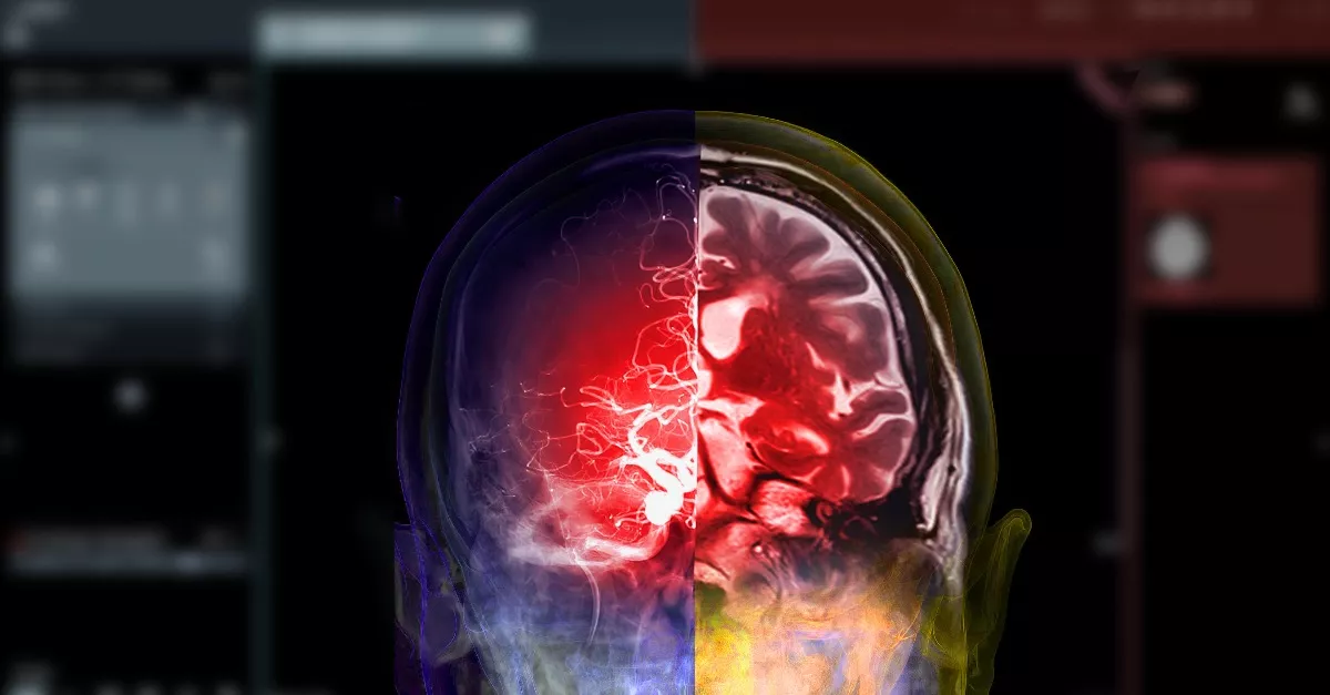 Tanulmány készült: ezt látjuk valójában a halálunk előtti utolsó pillanatban