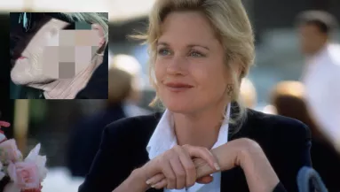 Bőrrákkal diagnosztizálták, aggasztó sebbel az arcán fotózták le Melanie Griffith-et - Fotók