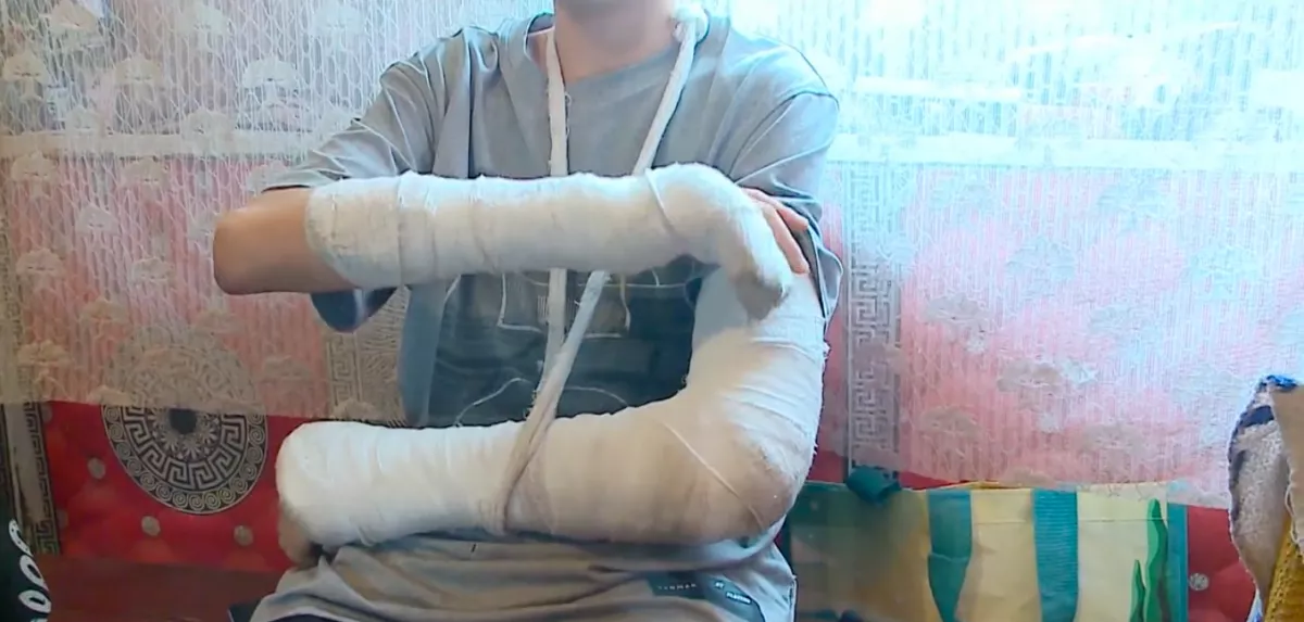 Horror Zagyvarékason: osztálytársa törte el a 11 éves kisfiú mindkét kezét - Videó