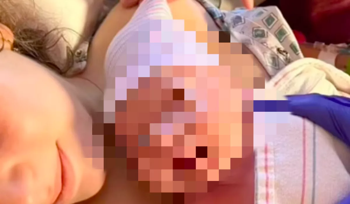 Az orvosok is ledöbbentek a baba látványától - A védekezés ellenére fogant meg - Videó