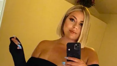 "Undorító" - írják ennek a lánynak, pedig már 21 milliót költött plasztikára - Fotók