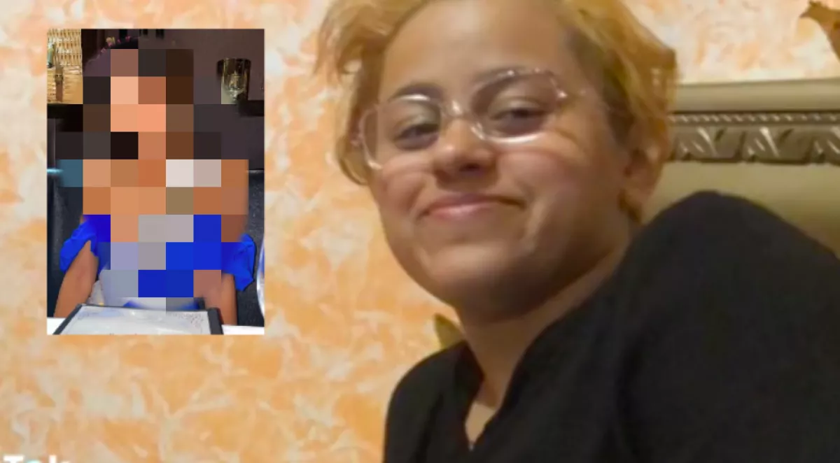 Nem akart többé "csúnya" lenni a lány, most minden férfi őt akarja - Fotók