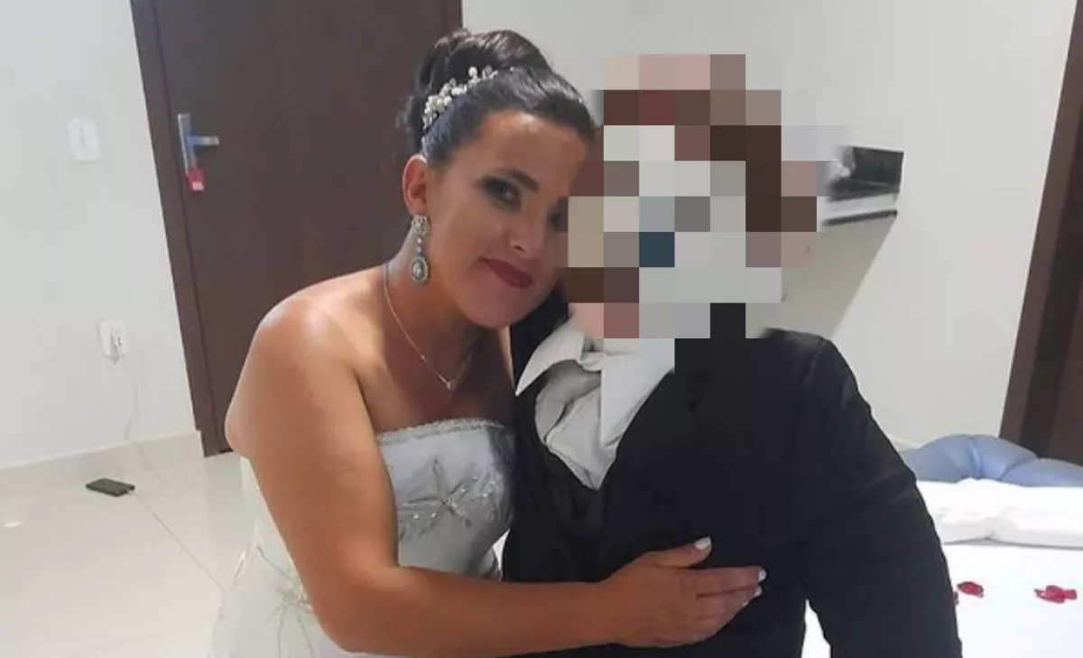 Arcplasztikára vitte férjét a nő, aki egy rongybabához ment hozzá - Fotók