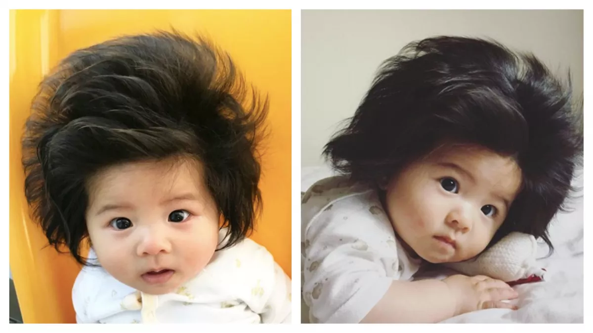 Emlékszel a világ leghajasabb kisbabájára? Így néz ki 5 évesen! - Fotók
