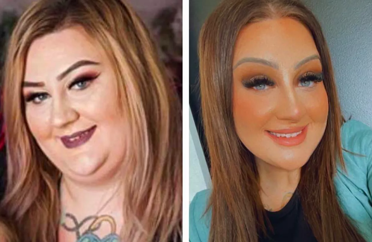 Közel egy mázsát fogyott a lány: egy rémálom vette így kezdetét - Fotók