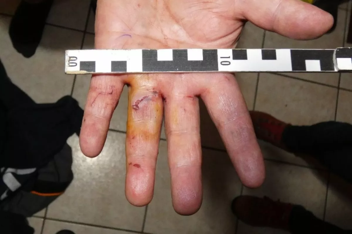 Berregő láncfűrésszel várta haza az apját István, majd horrora illő jelenetek kezdődtek Érden - Fotók