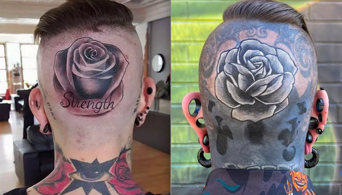 Szinte az egész teste fekete: szomorú történet áll a srác fejtetkója mögött - Fotók