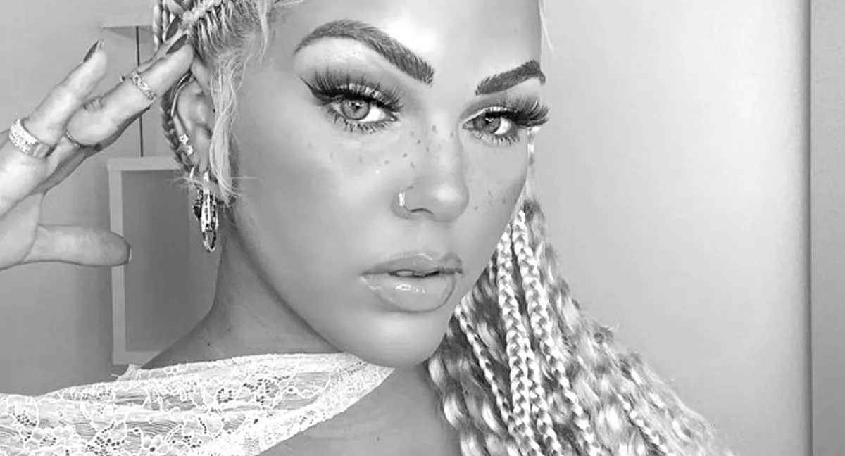 Vitatott plasztikai beavatkozásba halhatott bele a 32 éves influenszer anyuka - Fotók