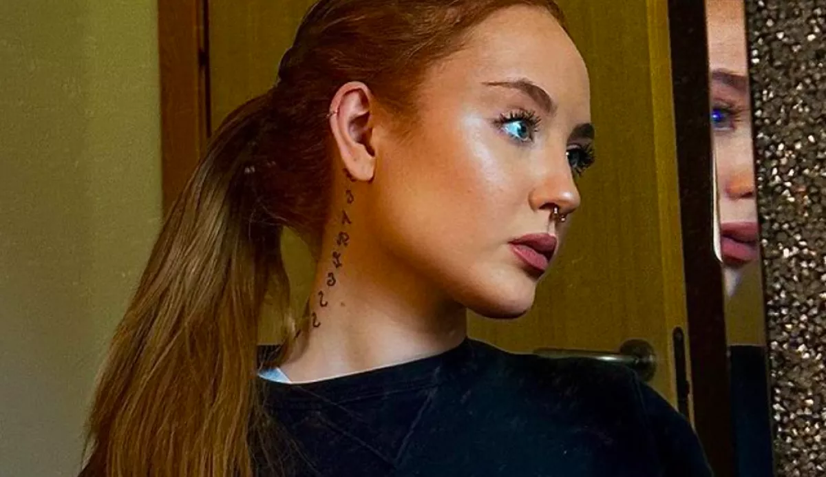 Sokkoló fotók: 25 kilóra fogyott 16 évesen az anorexiás lány, a haja is kihullott - Fotók