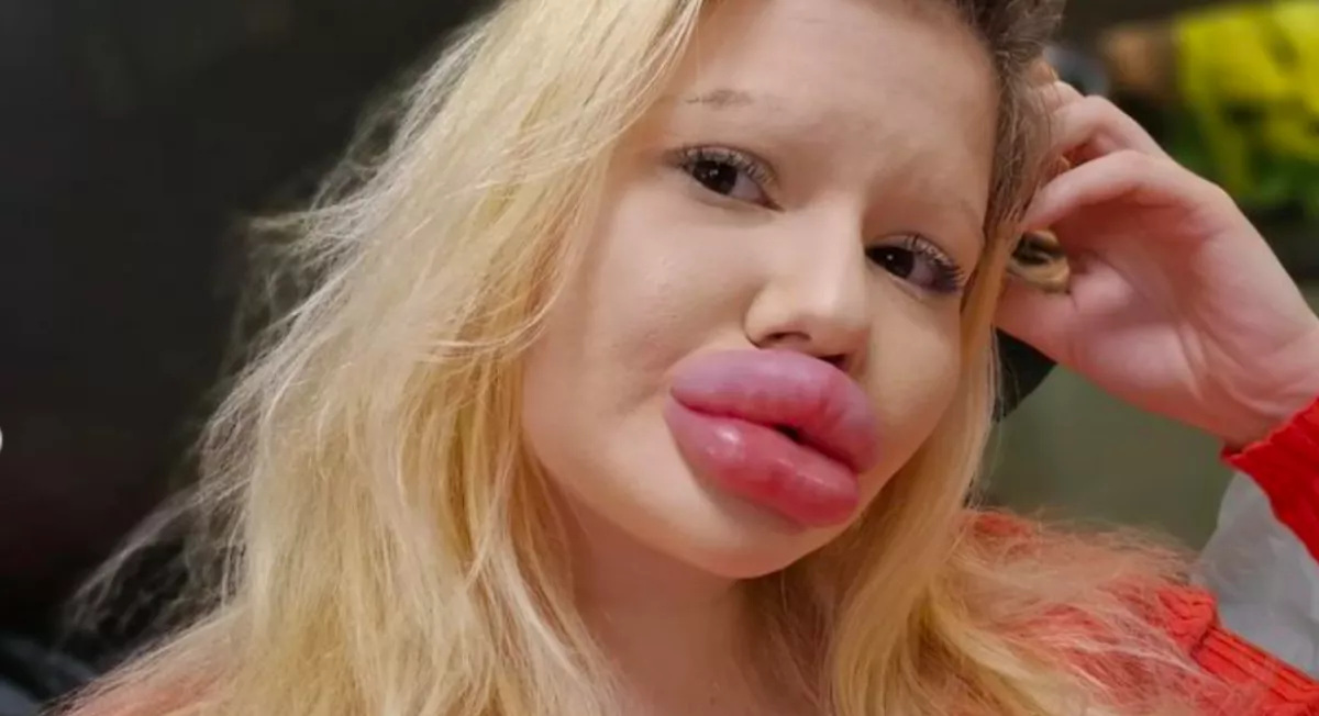 A világ legnagyobb ajkaival keres pasit Andrea - de van egy feltétele - Fotók