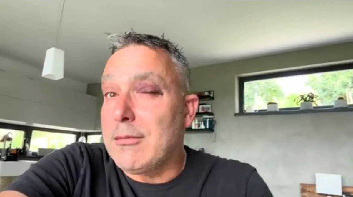 Sváby András megsérült: kiderült, ki veszi át a helyét a képernyőn - Videó