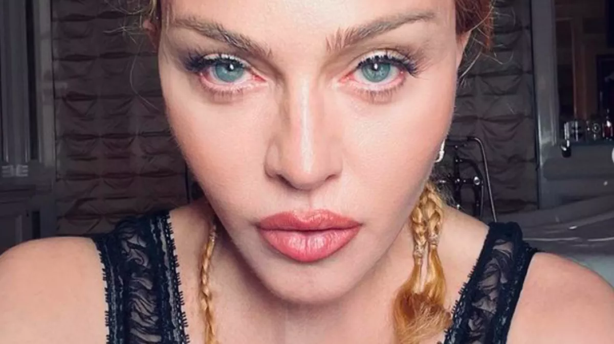 Bréking! Madonnát újra kellett éleszteni