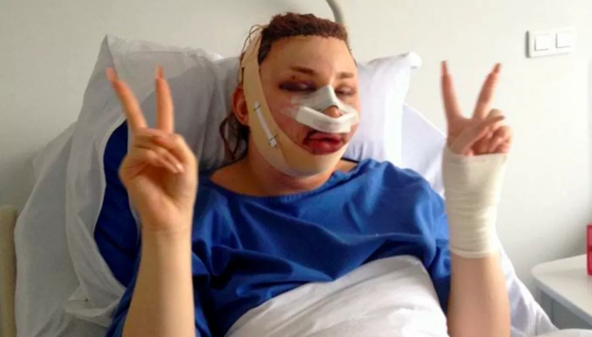 Több mint 50 milliót költött ez a srác, hogy élő cicababává operálják, de átesett a ló túloldalára - Fotók