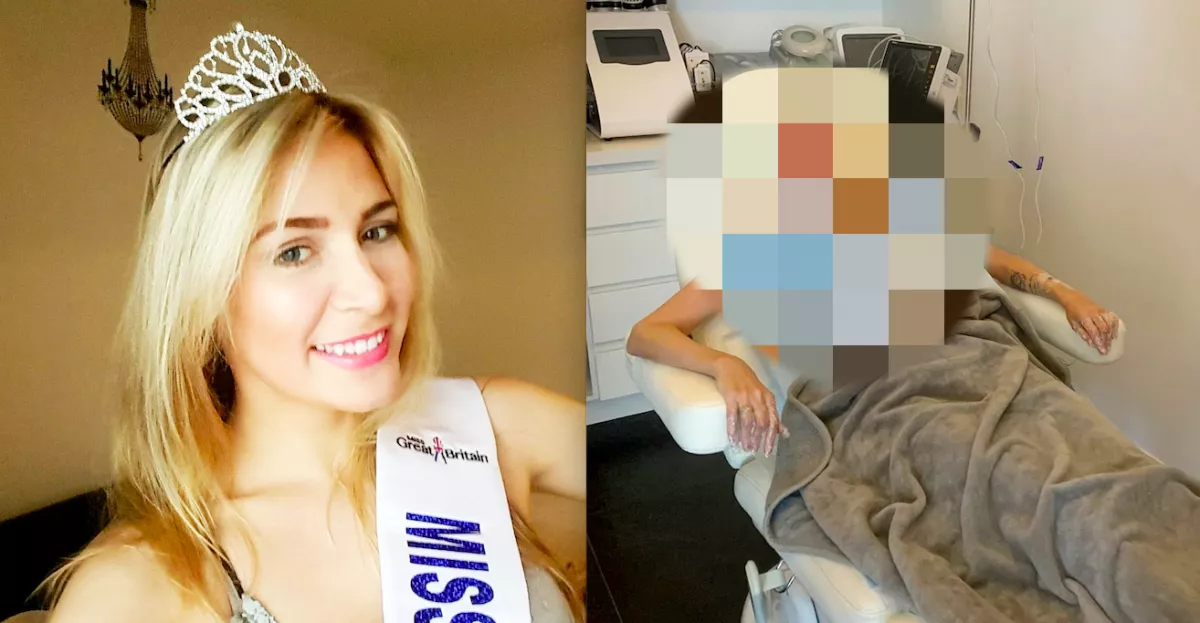 Kullancscsípés okozta szépségkirálynő vesztét: férje hordja a mosdóba is - Fotók