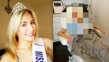 Kullancscsípés okozta szépségkirálynő vesztét: férje hordja a mosdóba is - Fotók