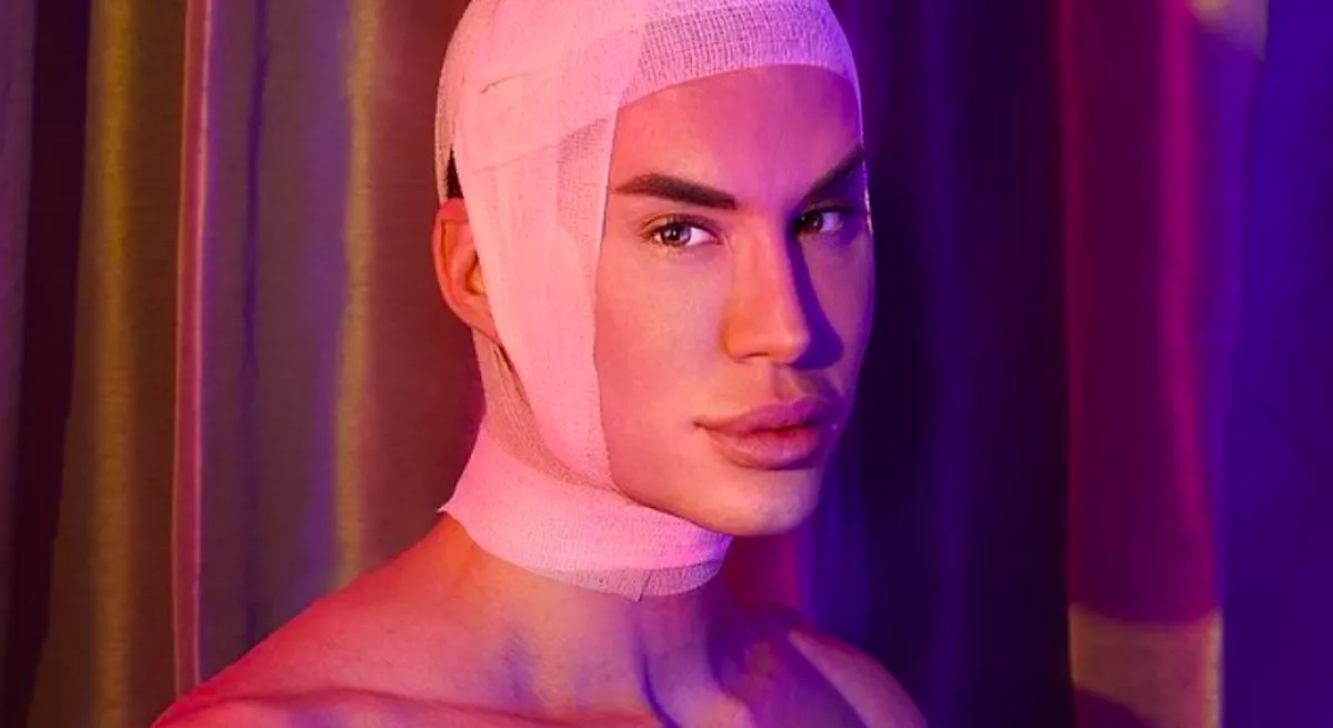 330 milliót fizetett plasztikáért az élő Ken baba: farkasra akar hasonlítani - Fotók