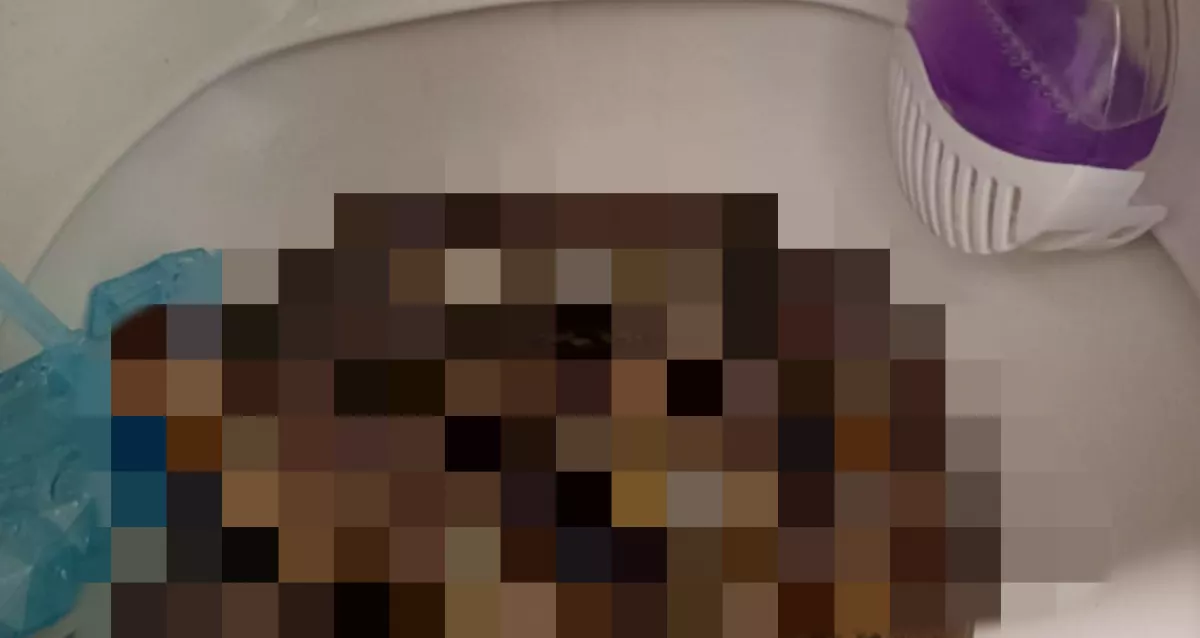 WC-re ment a nő az otthonában: sokkot kapott, amikor belenézett a kagylóba - Fotó