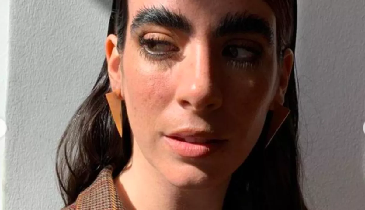 Hónapok óta nem borotválkozik Martina, már mindene szőrös és Tik-Tok sztár - Videók 