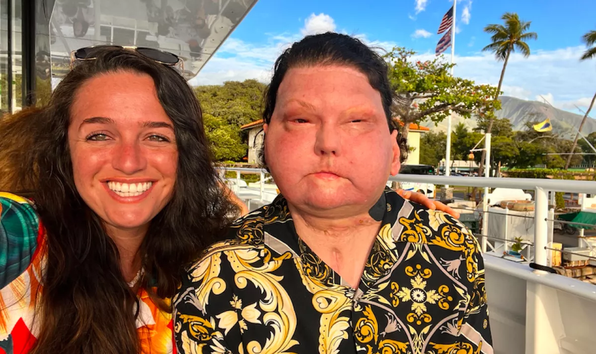 Trollok céltáblái: meglátta az arcátültetett fiút  a hírekben és azonnal beleszeretett - Fotók