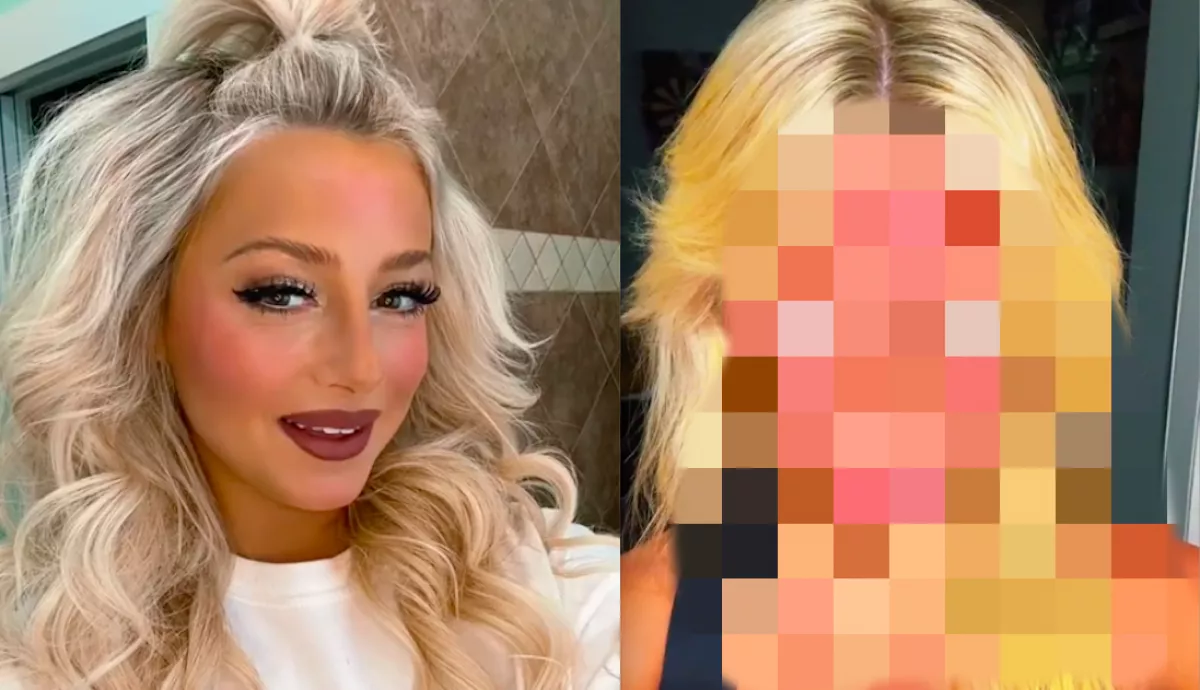 Összekeverte a naptejet a modell: sokkoló eredménye lett az egész testén - Videó