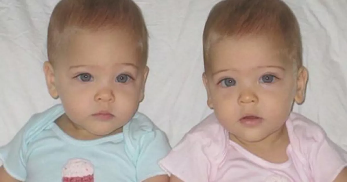 A világ legszebb ikreinek kiáltották ki őket 13 éve, így néznek ki ma - Fotók