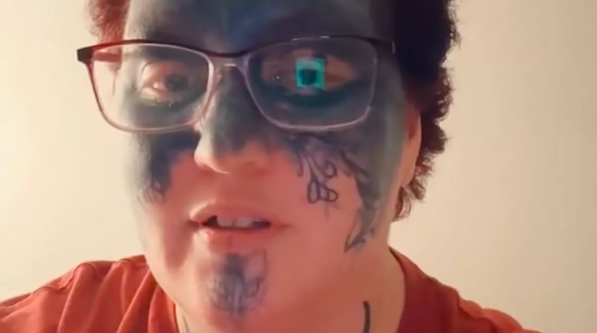 Mérhetetlen arcfájdalomra ébredt a nő a hotelszobában: az egész életére hatással lett, ami történt - Videó