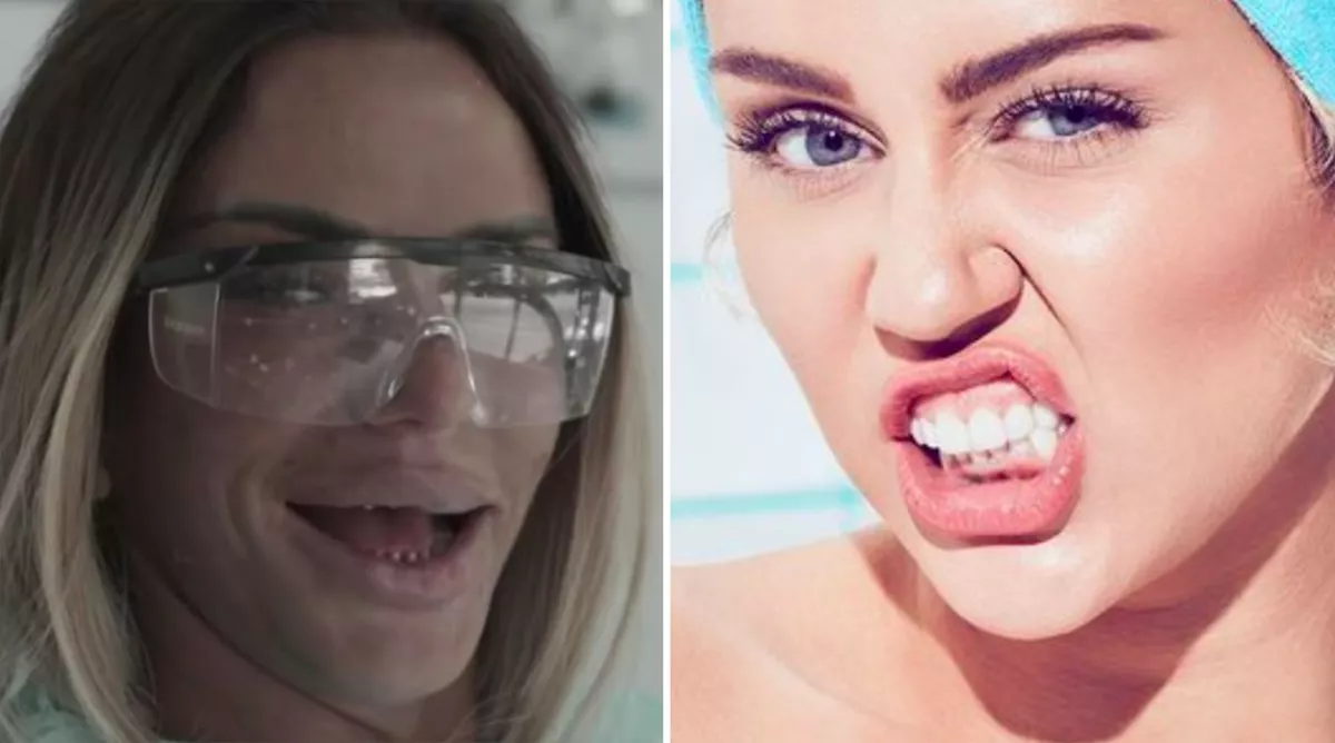 Sokkoló képek: így néztek ki a sztárok, mielőtt megcsináltatták a fogsorukat - Fotók