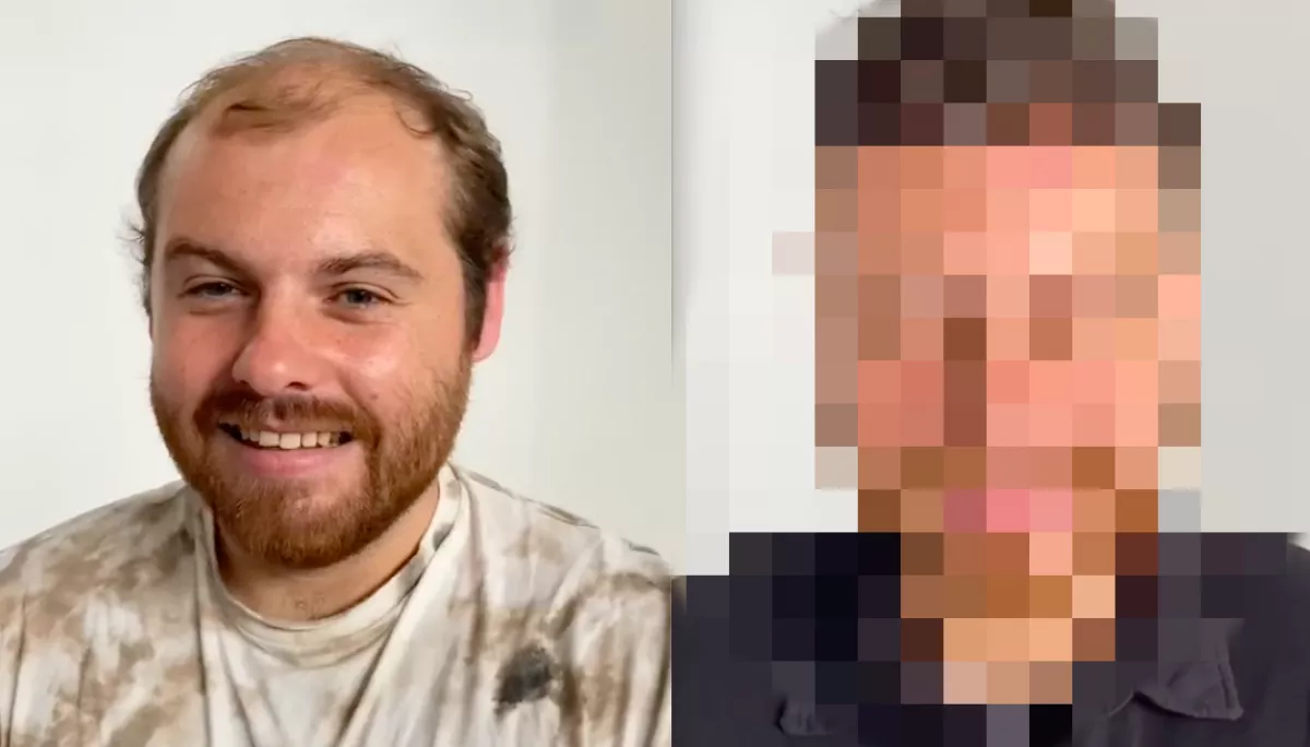 Parókát kapott a 29 éves kopasz srác: amikor meglátta magát, nem hitt a szemének - Videó