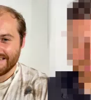 Parókát kapott a 29 éves kopasz srác: amikor meglátta magát, nem hitt a szemének - Videó