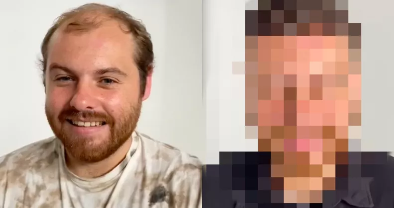 Parókát kapott a 29 éves kopasz srác: amikor meglátta magát, nem hitt a szemének - Videó