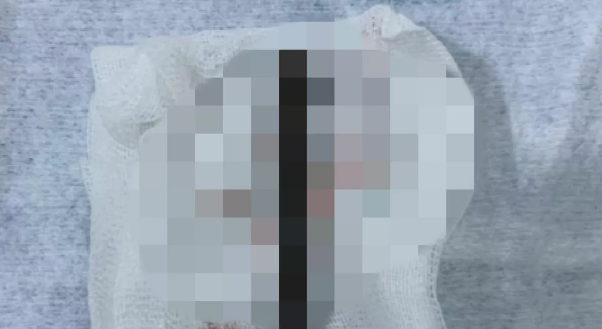 Fájt a pocakja a 4 éves kisfiúnak, a röntgenfelvétel sokkolta az orvosokat - Fotók