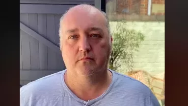 Eleredtek a kopasz férfi könnyei, amikor meglett magát az új parókájával - Videó